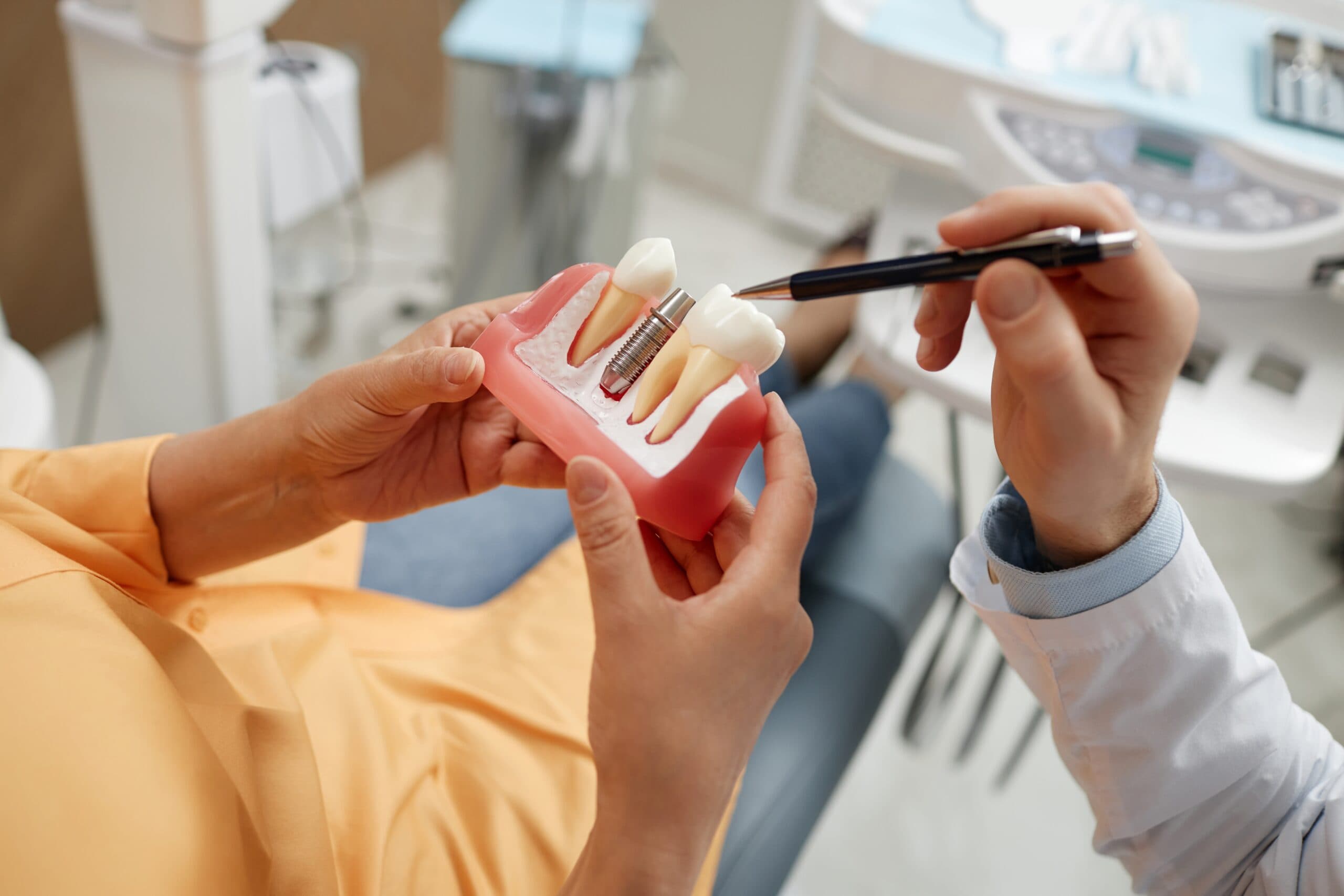 Dental Implants at BENE Dental