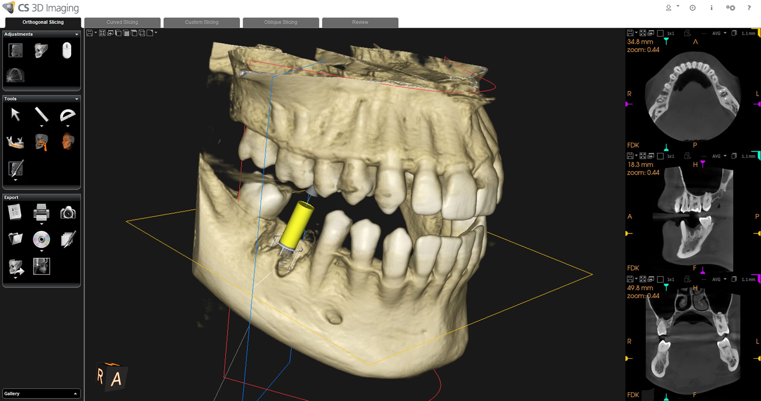 CT Imaging at BENE Dental
