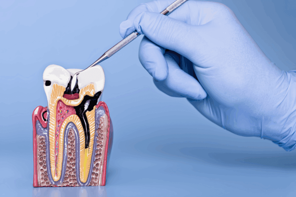 Cavity Treatment: Early Signs, Prevention, and Simple Solutions